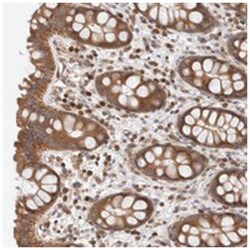 RP5-1000E104 Rabbit anti-Human, Polyclonal Antibody, Abnova 100&mu;L; Unlabeled:Antibodies,