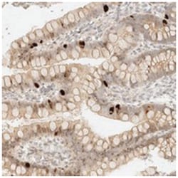 NRARP, Rabbit, Polyclonal Antibody, Abnova 100 &mu;L | Buy Online | Abnova Corporation | Fisher Scientific