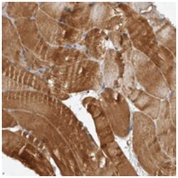 EDEM3 Rabbit anti-Human, Polyclonal Antibody, Abnova 100 &mu;L | Buy Online | Abnova Corporation | Fisher Scientific