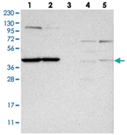 MRPL37 Rabbit anti-Human, Polyclonal Antibody, Abnova 100 &mu;L | Buy Online | Abnova Corporation | Fisher Scientific