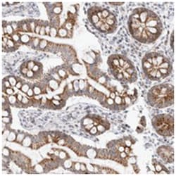 MRPL37 Rabbit anti-Human, Polyclonal Antibody, Abnova 100 &mu;L | Buy Online | Abnova Corporation | Fisher Scientific