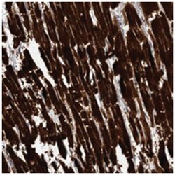 PGBD3, Rabbit, Polyclonal Antibody, Abnova 100 &mu;L | Buy Online | Abnova Corporation | Fisher Scientific