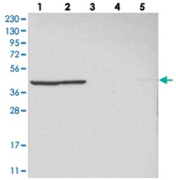 MRPL37 Rabbit anti-Human, Polyclonal Antibody, Abnova 100&mu;L; Unlabeled:Antibodies,