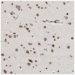 CDCA2 Rabbit anti-Human, Polyclonal Antibody, Abnova 100 &mu;L | Buy Online | Abnova Corporation | Fisher Scientific