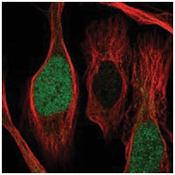 CDCA2 Rabbit anti-Human, Polyclonal Antibody, Abnova 100 &mu;L | Buy Online | Abnova Corporation | Fisher Scientific