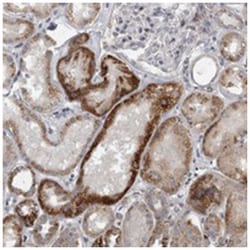 GSDMC, Rabbit, Polyclonal Antibody, Abnova 100 &mu;L | Buy Online | Abnova Corporation | Fisher Scientific