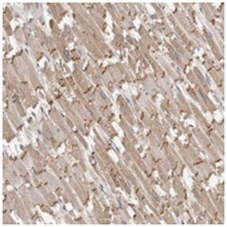RAB14, Rabbit, Polyclonal Antibody, Abnova 100 &mu;L | Buy Online | Abnova Corporation | Fisher Scientific