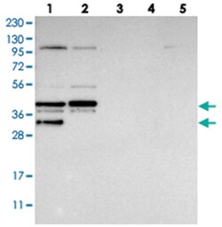EBNA1BP2, Rabbit, Polyclonal Antibody, Abnova 100 &mu;L | Buy Online | Abnova Corporation | Fisher Scientific