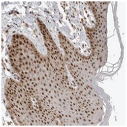 EBNA1BP2, Rabbit, Polyclonal Antibody, Abnova 100 &mu;L | Buy Online | Abnova Corporation | Fisher Scientific