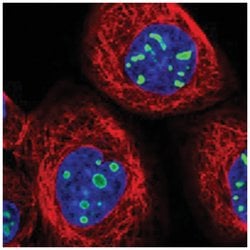 EBNA1BP2, Rabbit, Polyclonal Antibody, Abnova 100 &mu;L | Buy Online | Abnova Corporation | Fisher Scientific