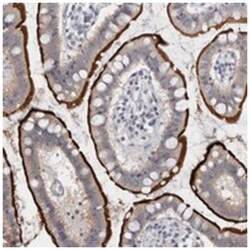 FNDC8, Rabbit, Polyclonal Antibody, Abnova 100 &mu;L | Buy Online | Abnova Corporation | Fisher Scientific