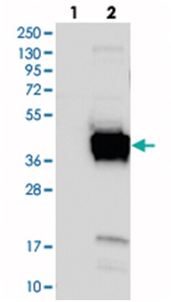 FNDC8, Rabbit, Polyclonal Antibody, Abnova 100 &mu;L | Buy Online | Abnova Corporation | Fisher Scientific