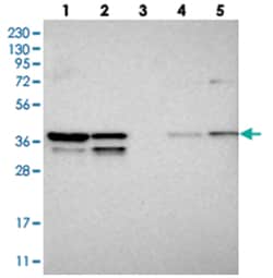 SNRNP40 Rabbit anti-Human, Polyclonal Antibody, Abnova 100&mu;L; Unlabeled:Antibodies,