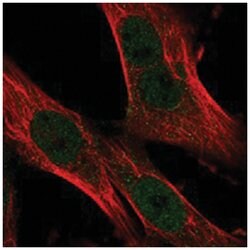 C17orf70 Rabbit anti-Human, Polyclonal Antibody, Abnova 100&mu;L; Unlabeled:Antibodies,