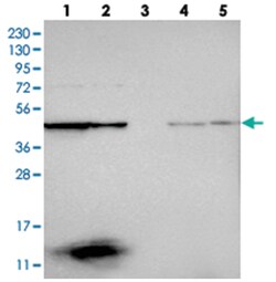 CCBL2 Rabbit anti-Human, Polyclonal Antibody, Abnova 100 &mu;L | Buy Online | Abnova Corporation | Fisher Scientific