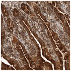 CCBL2 Rabbit anti-Human, Polyclonal Antibody, Abnova 100 &mu;L | Buy Online | Abnova Corporation | Fisher Scientific