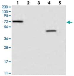 LRRC40, Rabbit, Polyclonal Antibody, Abnova 100 &mu;L | Buy Online | Abnova Corporation | Fisher Scientific
