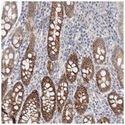 HCN3, Rabbit, Polyclonal Antibody, Abnova 100 &mu;L | Buy Online | Abnova Corporation | Fisher Scientific