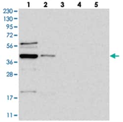 RBMX2, Rabbit, Polyclonal Antibody, Abnova 100&mu;L; Unlabeled:Antibodies,