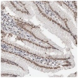 RBMX2, Rabbit, Polyclonal Antibody, Abnova 100&mu;L; Unlabeled:Antibodies,