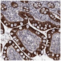 C1orf107, Rabbit, Polyclonal Antibody, Abnova 100 &mu;L | Buy Online | Abnova | Fisher Scientific