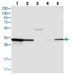 STARD10, Rabbit, Polyclonal Antibody, Abnova 100&mu;L; Unlabeled:Antibodies,