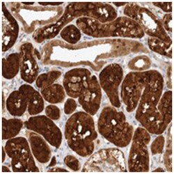 STARD10, Rabbit, Polyclonal Antibody, Abnova 100&mu;L; Unlabeled:Antibodies,