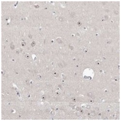 RBM28 Rabbit anti-Human, Polyclonal Antibody, Abnova 100 &mu;L | Buy Online | Abnova Corporation | Fisher Scientific