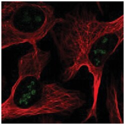 RBM28 Rabbit anti-Human, Polyclonal Antibody, Abnova 100 &mu;L | Buy Online | Abnova Corporation | Fisher Scientific