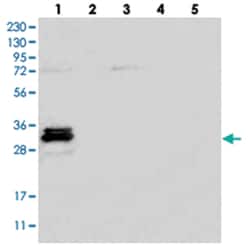 C7orf46 Rabbit anti-Human, Polyclonal Antibody, Abnova 100 &mu;L | Buy Online | Abnova Corporation | Fisher Scientific