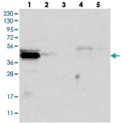 C9orf41, Rabbit, Polyclonal Antibody, Abnova 100 &mu;L | Buy Online | Abnova Corporation | Fisher Scientific