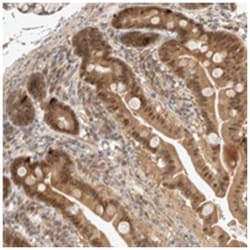 C9orf41, Rabbit, Polyclonal Antibody, Abnova 100 &mu;L | Buy Online | Abnova Corporation | Fisher Scientific
