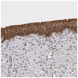 CHIC2, Rabbit, Polyclonal Antibody, Abnova 100&mu;L; Unlabeled:Antibodies,