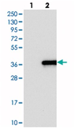 IQCK, Rabbit, Polyclonal Antibody, Abnova 100&mu;L; Unlabeled:Antibodies,