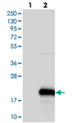 C1orf21, Rabbit, Polyclonal Antibody, Abnova 100&mu;L; Unlabeled:Antibodies,