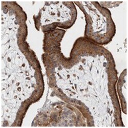 BNIP2 Rabbit anti-Human, Rat, Polyclonal Antibody, Abnova 100 &mu;L | Buy Online | Abnova Corporation | Fisher Scientific