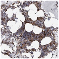 FCER1G, Rabbit, Polyclonal Antibody, Abnova 100 &mu;L | Buy Online | Abnova Corporation | Fisher Scientific
