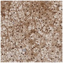 RTP2, Rabbit, Polyclonal Antibody, Abnova 100 &mu;L | Buy Online | Abnova Corporation | Fisher Scientific