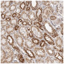 SLC25A26, Rabbit, Polyclonal Antibody, Abnova 100 &mu;L | Buy Online | Abnova Corporation | Fisher Scientific