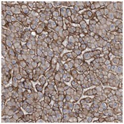 GLT8D2, Rabbit, Polyclonal Antibody, Abnova 100&mu;L; Unlabeled:Antibodies,