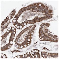 TMPRSS11F, Rabbit, Polyclonal Antibody, Abnova 100&mu;L; Unlabeled:Antibodies,