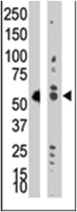 TRDMT1 Rabbit anti-Human, Mouse, Polyclonal Antibody, Abnova 400 &mu;L | Buy Online | Abnova Corporation | Fisher Scientific