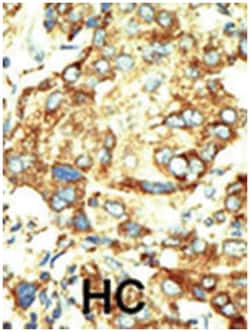 TRDMT1 Rabbit anti-Human, Mouse, Polyclonal Antibody, Abnova 400 &mu;L | Buy Online | Abnova Corporation | Fisher Scientific