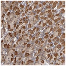 PARP6 Rabbit anti-Human, Rat, Polyclonal Antibody, Abnova 100&mu;L; Unlabeled:Antibodies,