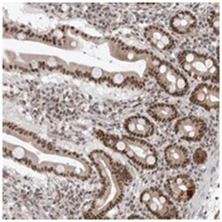 PRDM10, Rabbit, Polyclonal Antibody, Abnova 100 &mu;L | Buy Online | Abnova Corporation | Fisher Scientific
