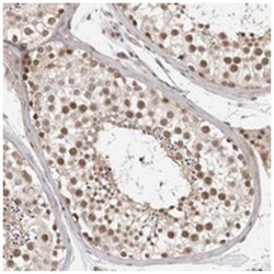 ZNF318 Rabbit anti-Human, Polyclonal Antibody, Abnova 100 &mu;L | Buy Online | Abnova Corporation | Fisher Scientific