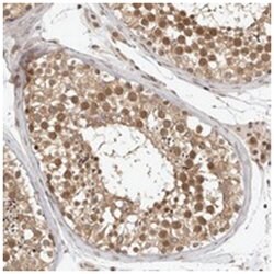 ZNF318 Rabbit anti-Human, Polyclonal Antibody, Abnova 100&mu;L; Unlabeled:Antibodies,