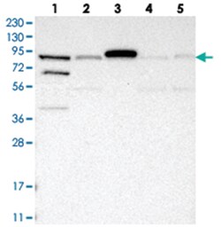 SPATA20 Rabbit anti-Human, Polyclonal Antibody, Abnova 100 &mu;L | Buy Online | Abnova Corporation | Fisher Scientific