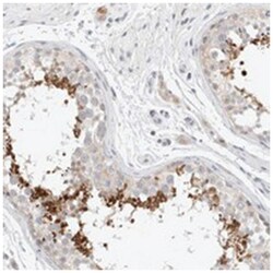 SPATA20 Rabbit anti-Human, Polyclonal Antibody, Abnova 100 &mu;L | Buy Online | Abnova Corporation | Fisher Scientific