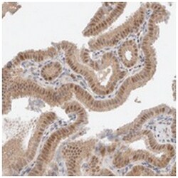 ERI3, Rabbit, Polyclonal Antibody, Abnova 100 &mu;L | Buy Online | Abnova Corporation | Fisher Scientific